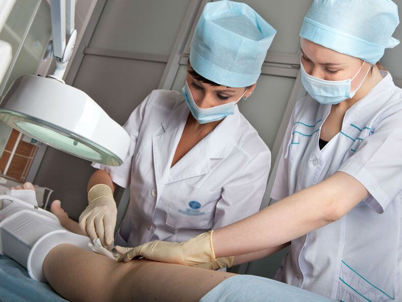 Laser ablation to treat varicose veins